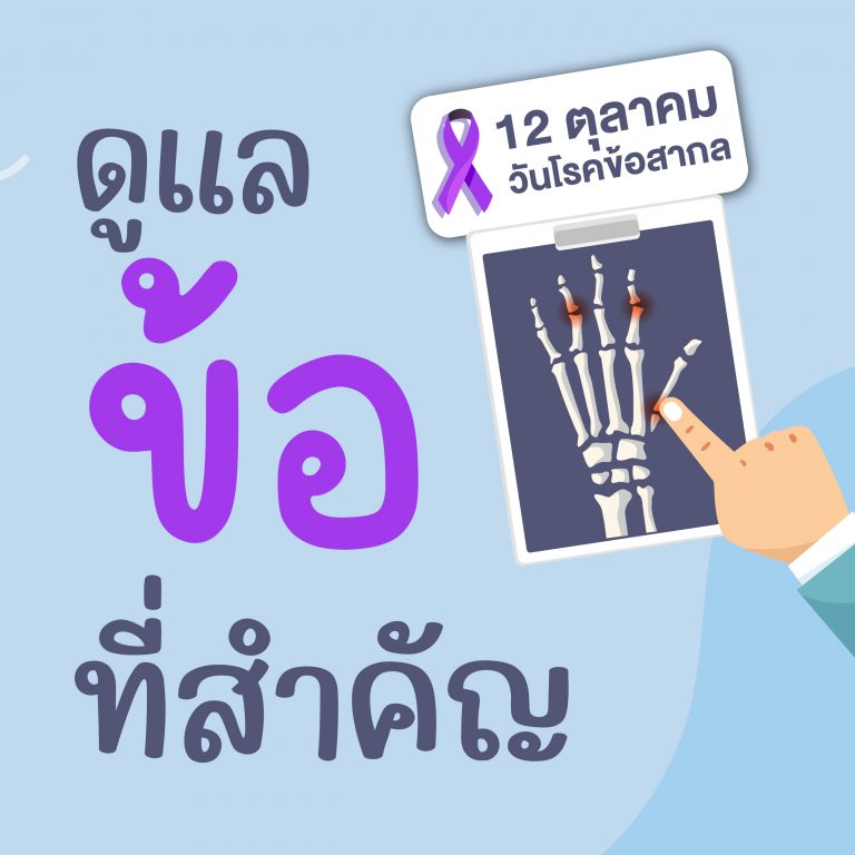 ดูแล ข้อ ที่สำคัญ