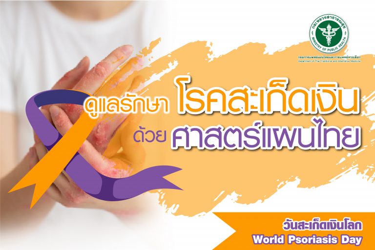 ดูแลโรคสเก็ดเงิน ด้วยศาสตร์แผนไทย